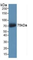 AKAP11 / KIAA0629 Antibody (aa159-258)