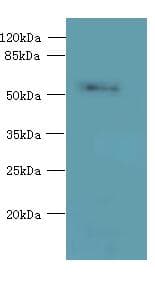 Polyclonal Rabbit anti-Human OSGIN2 Antibody (IHC, WB)