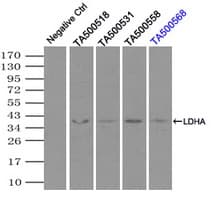 Monoclonal Mouse anti-Human LDHA / LDH1 Antibody (clone OTI2D11, IHC, WB)