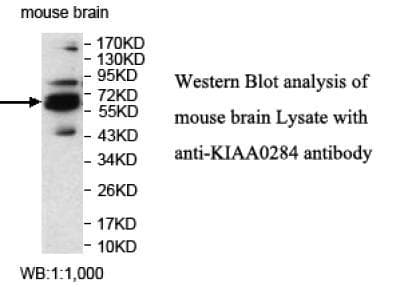 Polyclonal Rabbit anti-Human KIAA0284 Antibody (aa1444-1583, IHC, WB)