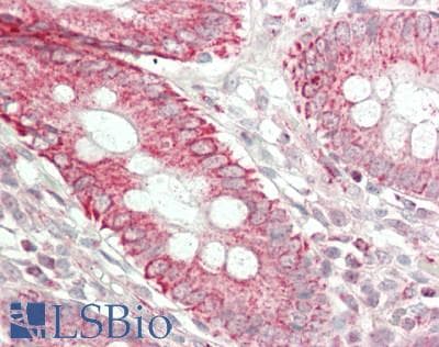 IHC-plus™ Prostaglandin D2 Receptor Antibody (C-Terminus)