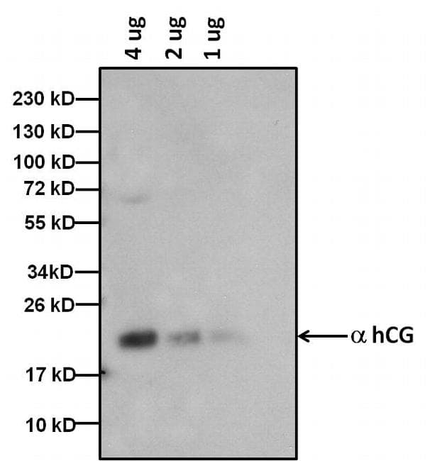 hCG / Chorionic Gonadotropin Antibody (clone 3015)