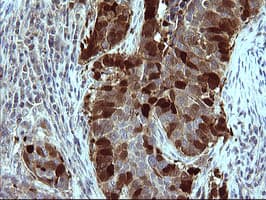 SERPINB3 Antibody (clone OTI1G5)