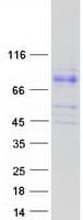 Human LRWD1 Protein (Recombinant Myc-DDK (Flag))