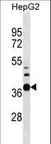 Polyclonal Rabbit anti-Human RPUSD1 Antibody (aa178-205, WB)