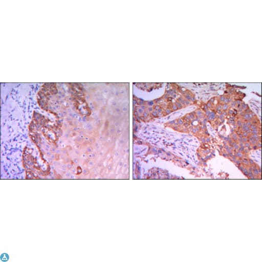RAB25 Antibody