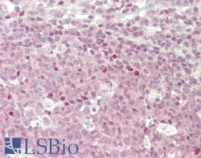 IHC-plus™ PPP1CA / PP1-Alpha Antibody
