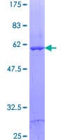 Human DECR2 Protein (Recombinant GST)
