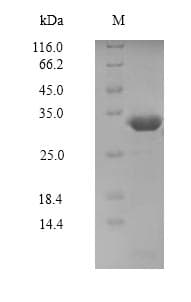 Human PAK7/PAK5 Protein (Recombinant 6His, N-terminus)