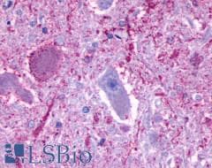 PathPlus™ GPR137 Antibody (Extracellular Domain)