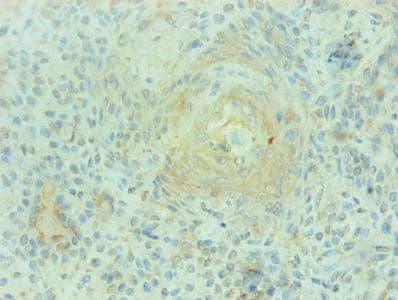 Monoclonal Mouse anti-Human S100A9 / MRP14 Antibody (clone 1G1C1, IHC)