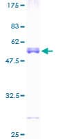 Human TPD52L2 / HD54 Protein (Recombinant GST)