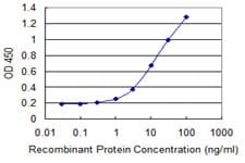 IHC-plus™ Monoclonal Mouse anti-Human MDH / MDH2 Antibody (clone 1G12, IHC, WB)