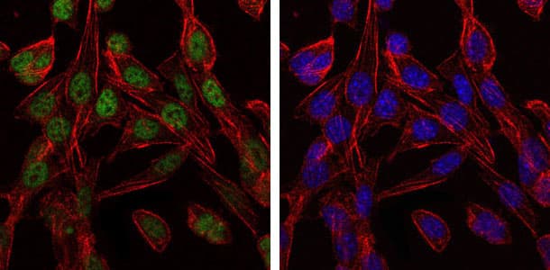 CCT2 / CCT Beta Antibody (clone 5B5C4)