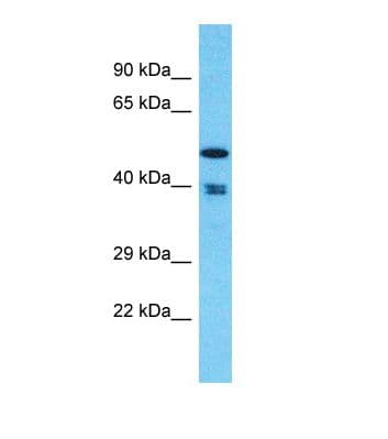 THUMPD1 Antibody (C-Terminus)