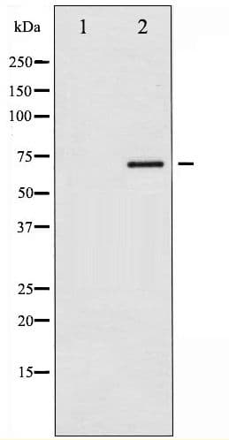 Polyclonal Rabbit anti-Human ER Alpha / Estrogen Receptor Antibody (phospho-Ser118, IHC, WB)