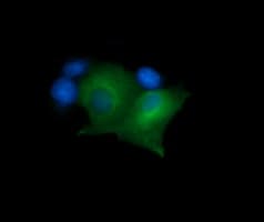 MAP2K1 / MKK1 / MEK1 Antibody (clone OTI7E2)
