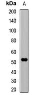 Polyclonal Rabbit anti-Human ETS2 Antibody (IF, WB)