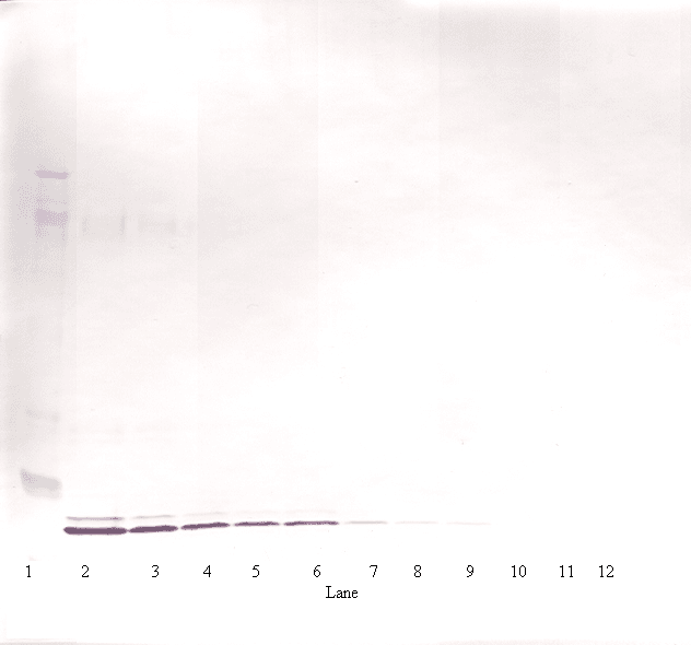 Polyclonal Rabbit anti-Human IL19 Antibody (WB)