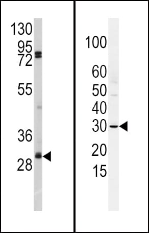 SNAI2 / SLUG Antibody (aa1-30)