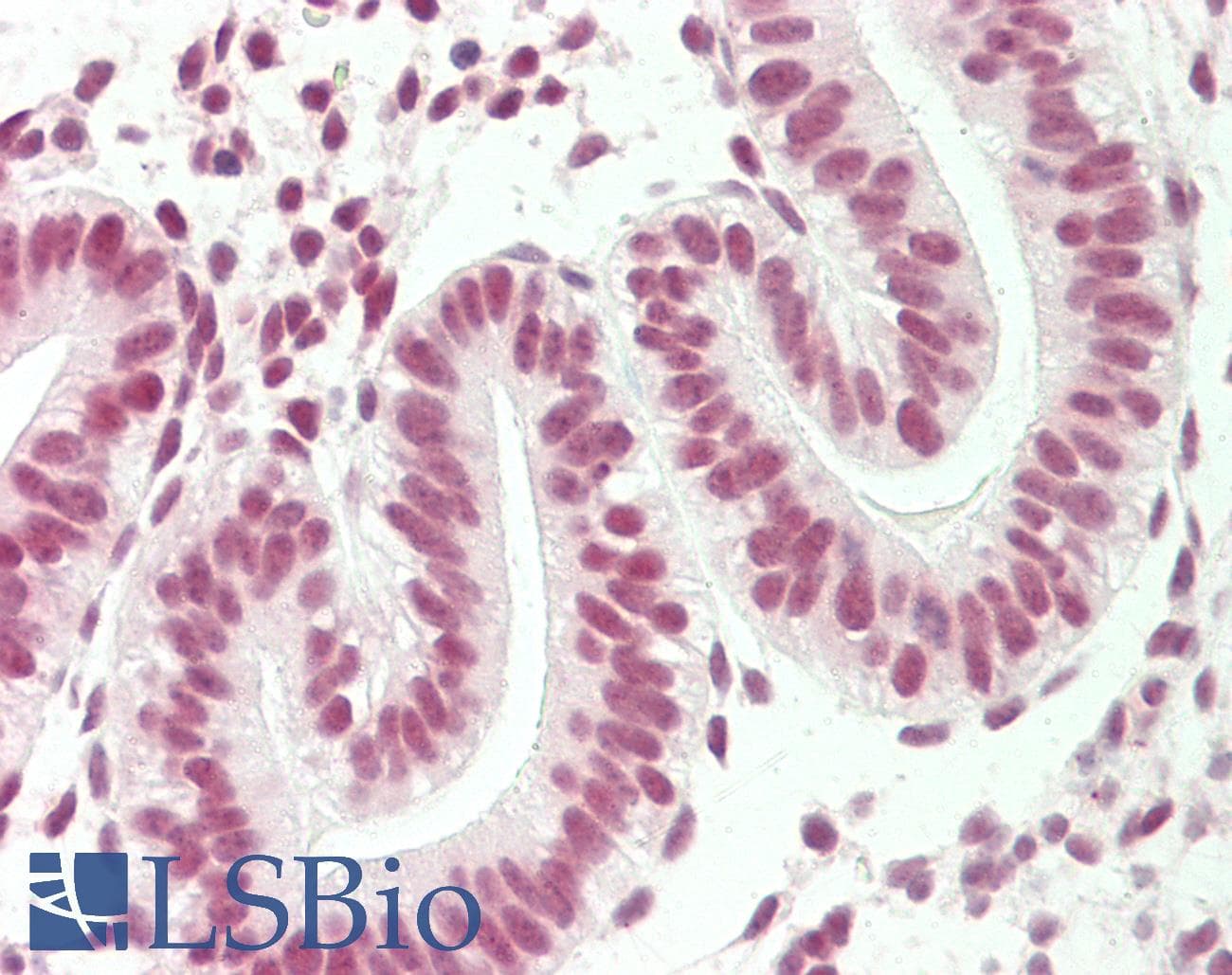IHC-plus™ STAG2 Antibody (aa1125-1175)