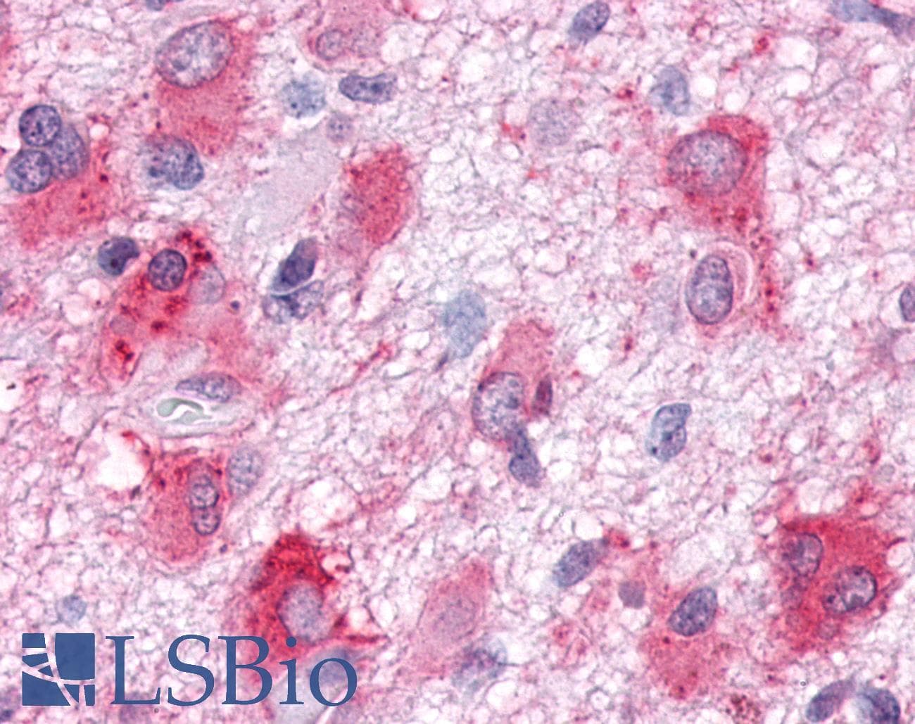 PathPlus™ GPR63 Antibody (C-Terminus)