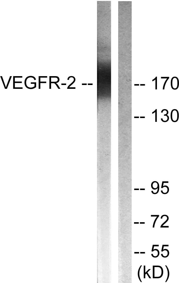 Polyclonal Rabbit anti-Human KDR / VEGFR2 / FLK1 Antibody (aa1025-1074, WB)