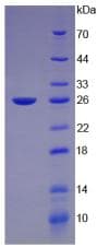 Mouse GH / Growth Hormone Protein (Recombinant His-T7)