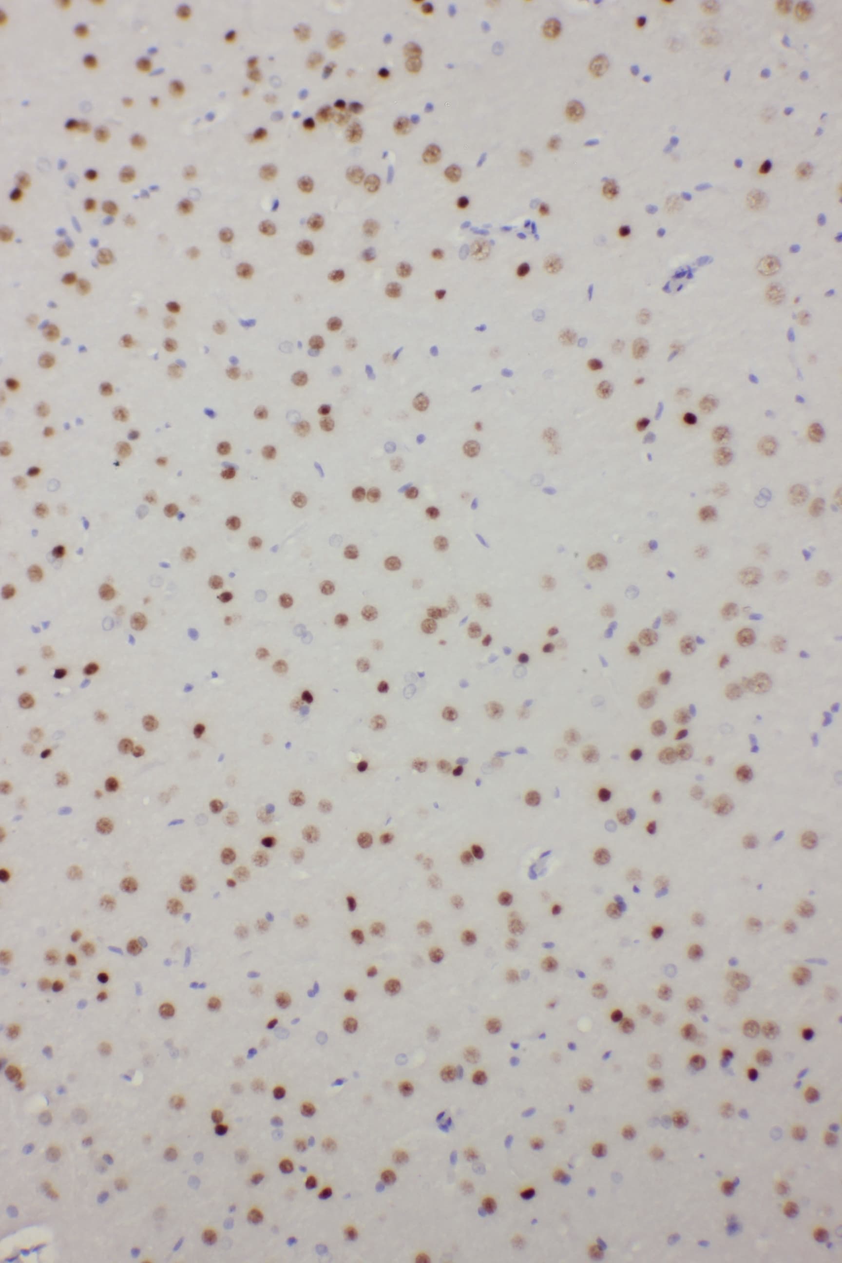 PDK2 Antibody (aa379-392)