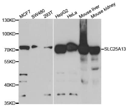 SLC25A13 / CITRIN Antibody
