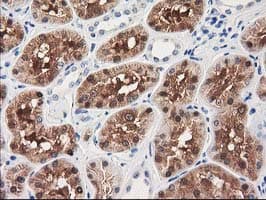 GRHPR / Glyoxylate Reductase Antibody (clone OTI1H8, Carrier-free)