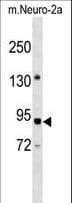 Polyclonal Rabbit anti-Human PWP2H / PWP2 Antibody (aa567-596, WB)