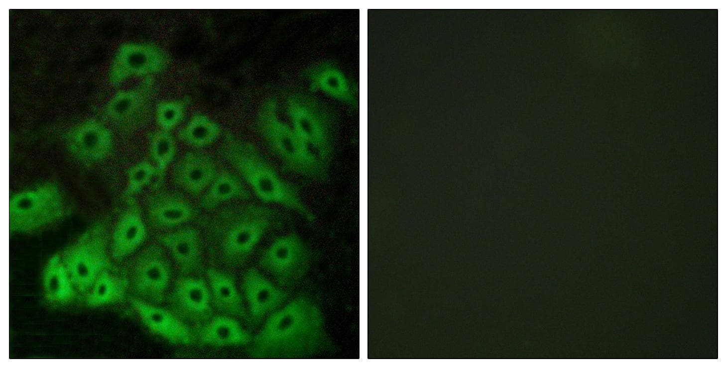VN2R1P Antibody