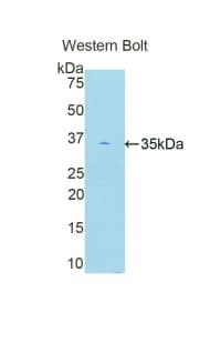 PRKCB / PKC-Beta Antibody (aa342-600)