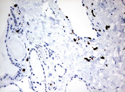PBX1 Antibody (clone UMAB110)