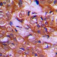 Polyclonal Rabbit anti-Human DZIP3 Antibody (Internal, IHC, WB)