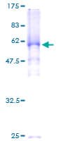 Human SGOL1 / Shugoshin Protein (Recombinant GST)