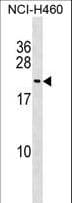 FUNDC1 Antibody (aa79-108)