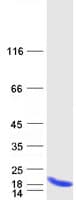 Human C19orf53 Protein (Recombinant Myc-DDK (Flag))