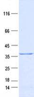 Human MAPRE1 / EB1 Protein (Recombinant DDK,C-terminus)