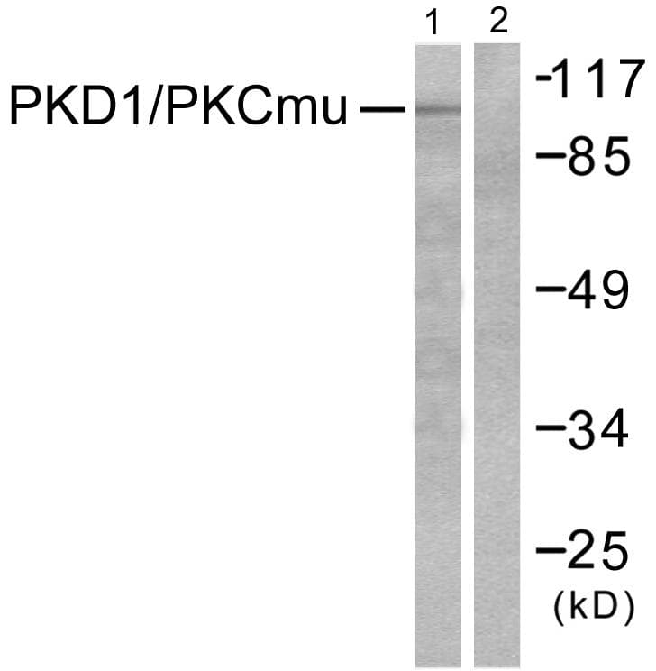 PRKD1 / PKC Mu Antibody (p910)