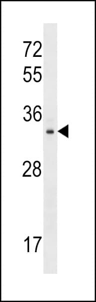 TIGAR Antibody (aa1-30)