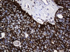 HSPD1 / HSP60 Antibody (clone OTI6F7)