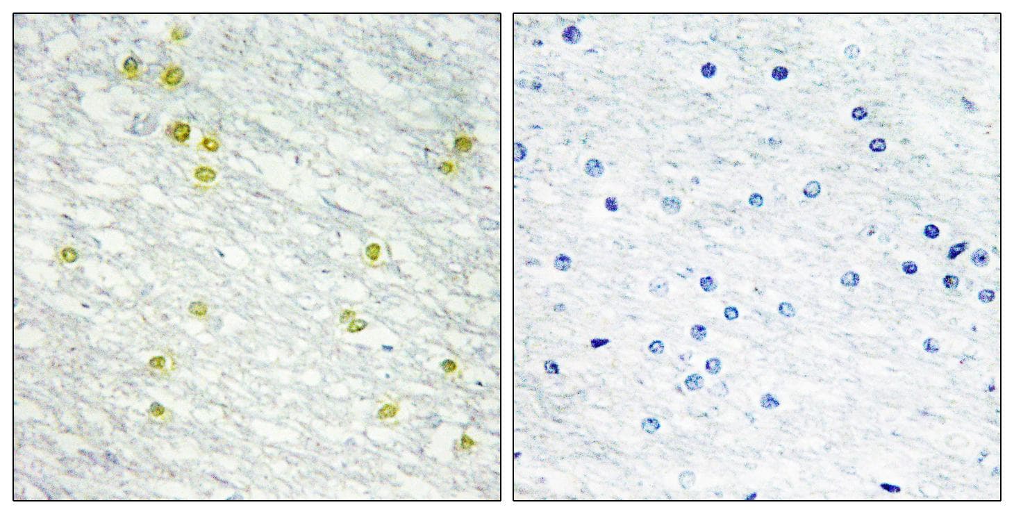 MED14 Antibody