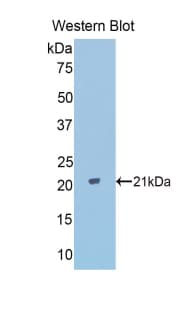 PPARD / PPAR Delta Antibody (aa260-426)