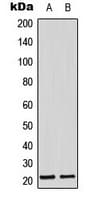 Polyclonal Rabbit anti-Human ADM / Adrenomedullin Antibody (Internal, WB)