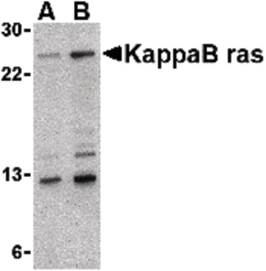 Polyclonal Rabbit anti-Human NKIRAS1 Antibody (IHC, WB)