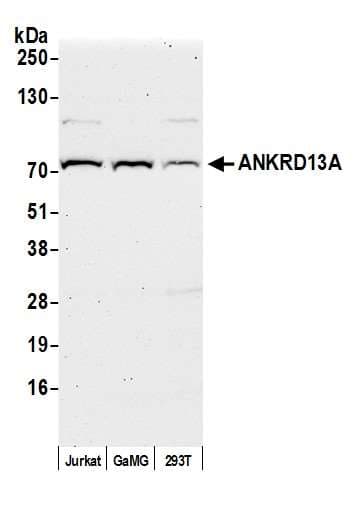 Polyclonal Rabbit anti-Human ANKRD13A Antibody (aa540-590, WB)