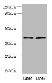 IHC-plus™ DCN / Decorin Antibody (aa 20-359)