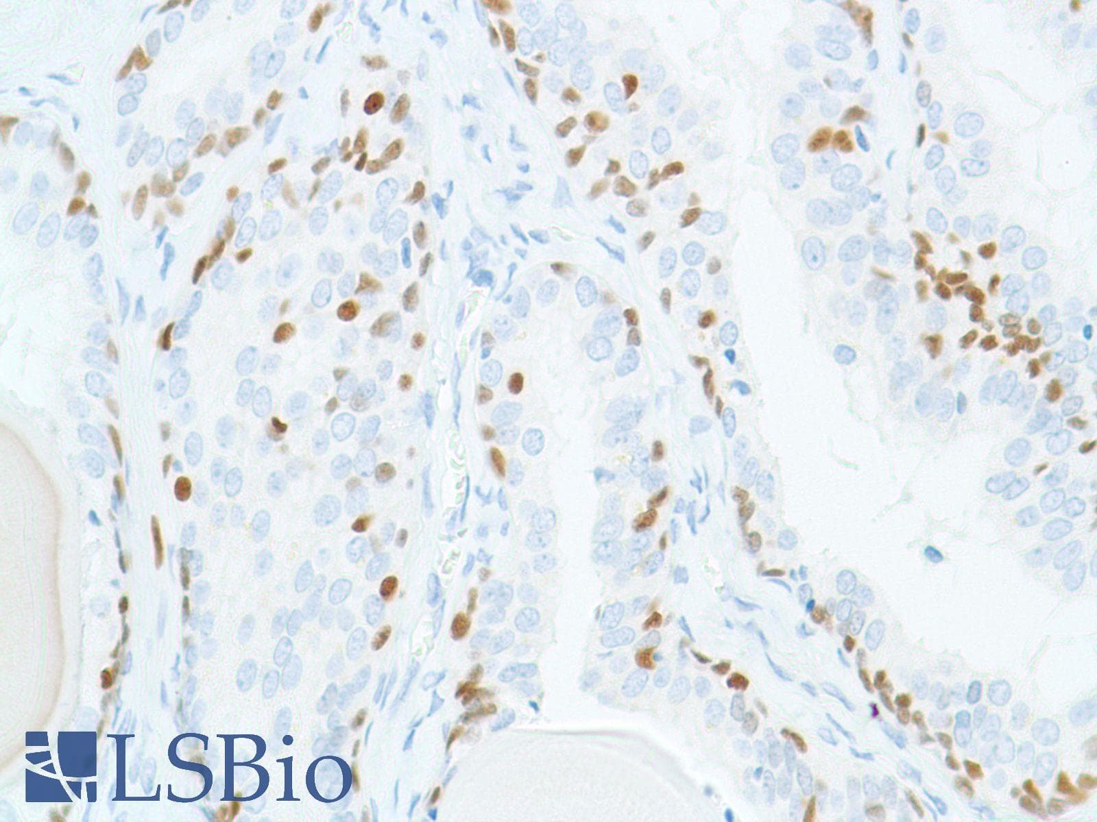 SOX2 Antibody (N-Terminus, clone SP76)